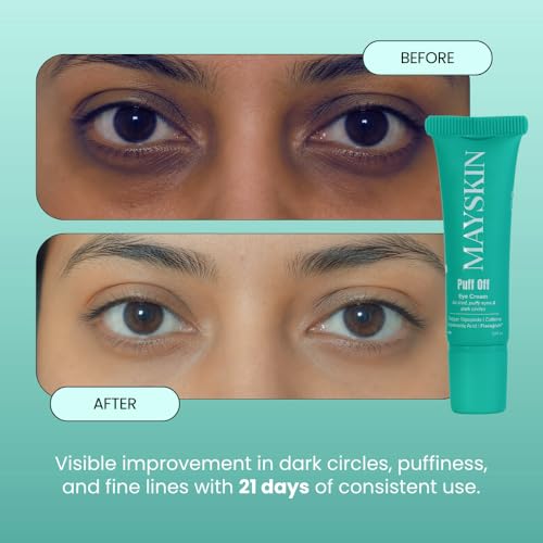 Image of Puff Off Eye Cream - Retinal, Copper Peptides & Caffeine for Dark Circles, Puffiness & Fine Lines | Bifida Ferment Lysate & 7 Botanicals | Dermatologically Tested | For Women & Men | 10ml