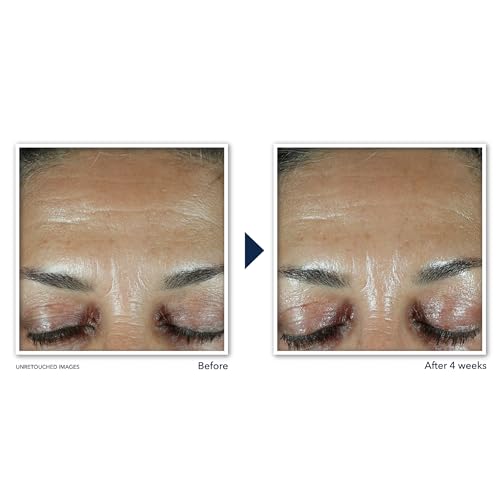 Roc 3.81371E+11 Retinol Correxion Deep Wrinkle Facial Filler thumb #2