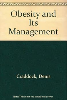 Paperback Obesity and its management Book