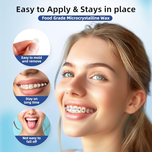 RAZOKO Kiefergerechtes Wachs für Zahnspangen Wax Dots 120 Einzelne Hygieneverpackung Zahnwachs Mint
