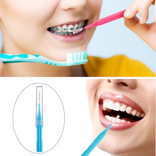 image for Patelai 100 Pieces Braces Brush for Cleaner Interdental Brush Toothpic
