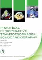 Practical Perioperative Transoesophageal Echocardiography