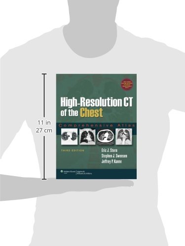High-Resolution CT of the Chest: Comprehensive Atlas