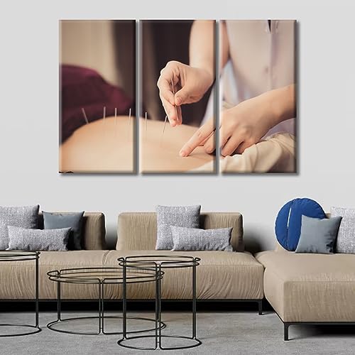 Image of TUMOVO 3 Panels Acupuncture and Moxibustion Large Wall Art Traditional Chinese Medicine Wall Art for Living Room Traditional Art Prints Giclee Print Stretched and Framed Ready to Hang (60 inch Wx40 H)