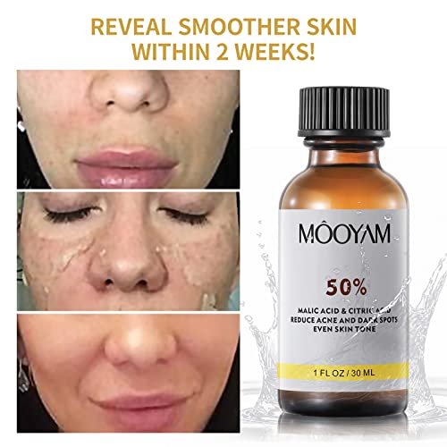 50% Citric Acid Peeling Serum, Professional Chemical Peel For Face, Peeling Solution, Chemical Exfolianting Facial Peel For Dark Skin, Dark Spots, Acne, Wrinkle - 30Ml/1 Fl Oz (50% Citric Acid) #TOP1