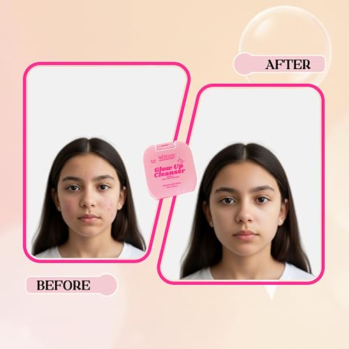 Image of Whimsy Beauty Vitamin E Face & Body Cleanser for Kids & Preteens | Gentle Daily Wash with Aloe Vera, Blood Orange & Niacinamide | 4-16 Years | Organic, Sulfate & Paraben Free | Dermatologist Tested | 180 ml