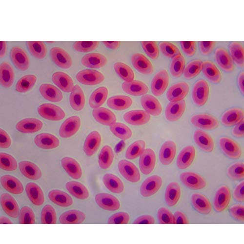 Omax 40X-2000X Digital Binocular Phase Contrast Compound Microscope With Built-In 3.0Mp Usb And Interchangeable Phase Contrast Kit (Md827S30-Phd) #TOP7