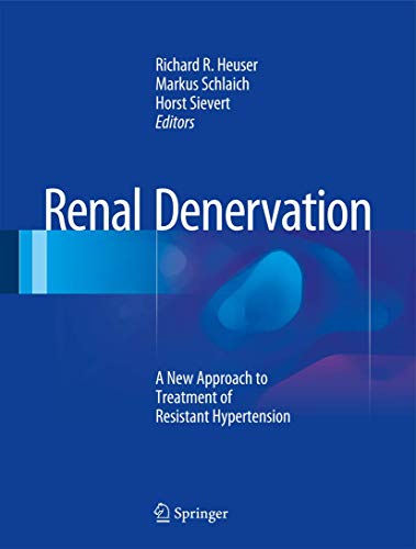 Renal Denervation view 2