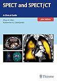 SPECT and SPECT/CT: A Clinical Guide