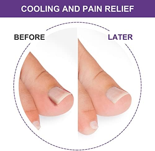 Toenail Corrector Patch, Ingrown Toe Nail Treatment, No Glue for Ingrown Curved Toenails Painless Treatment with Nail Correction Tool