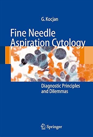 Fine Needle Aspiration Cytology: Diagnostic Principles and Dilemmas Softcover reprint of the original 1st ed. 2006 Edition-Wow! eBook