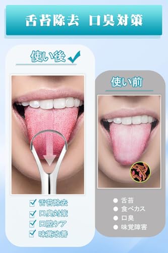 Griowenke 舌ブラシ 2本セット 大開口タイプ の商品画像 4