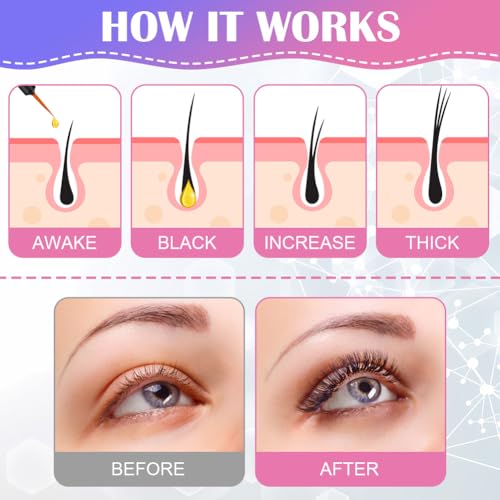 LOPHE Eyelash Growth Serum, Lash Treatment Serum Powerful Natural Ingredients Lash & Brow Serum, Eyelash Booster - Image 4