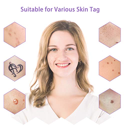 Top 10 Best acne laser pen Reviews NecoleBitchie