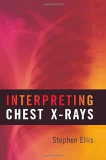 Interpreting Chest X-rays by Stephen Ellis (12-Apr-2010) Paperback