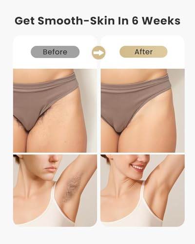 Laser Hair Removal for Women and Men - 5.2 cm² Contact Nearly Painless, Powerful Long-Lasting IPL Hair Removal at-home, Effective in 14 Days with Ultra-fast Light Emission for Whole Body Use - Image 6