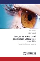 Mooren's ulcer and peripheral ulcerative keratitis 3659502677 Book Cover