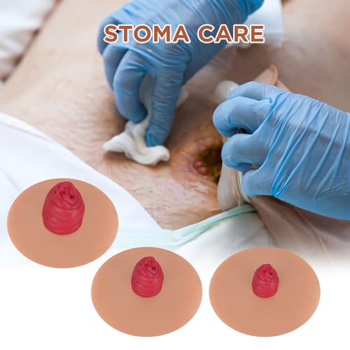Image of Sticky Ileostomy Simulators, Stoma Training Model Set | Ostomy Care Practice Models for Medical Training and Patient Education, Tan