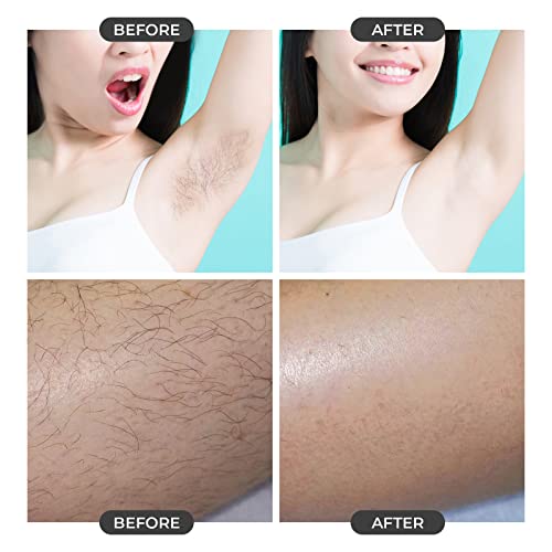 O-NINE-Crystal-Hair-Eraser-for-Women-and-Men-Magic-Remover-Painless-Exfoliation-Removal-Tool-Arms-Legs-Back-Reusable-Washable-Fast-Easy-Best-Portable-Epilator-Black-28-ounces