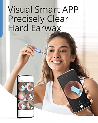 Bebird Ear Wax Removal Tool Kit, Ear Cleaner With 1080P Ear Camera, Smart Visual Earwax Removal Kit With 7 Pcs Ear Set For Daily Ear Pick, 6 Led Lights, 5 Ear Scoop Ear Tips Replacement, Blue #TOP7