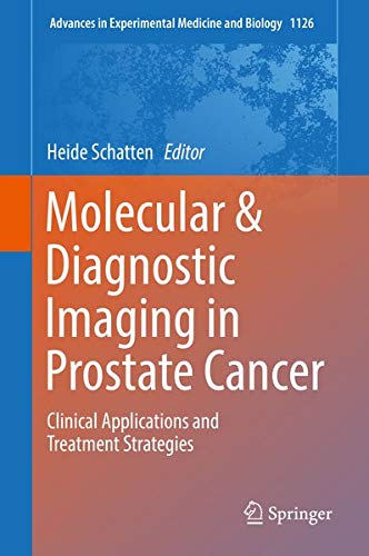 Buy Molecular & Diagnostic Imaging in Prostate Cancer — BookShops.in