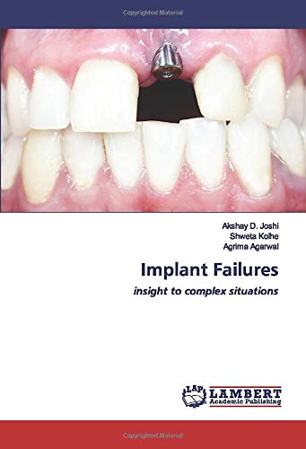 Implant Failures