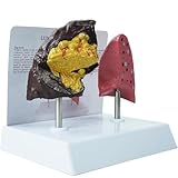 [Alta qualità]: Realizzato in PVC atossico e inodore, il resistente modello anatomico dei polmoni riproduce i complessi dettagli patologici, supportando al contempo le presentazioni in aula e cliniche per una lunga durata.