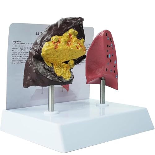 [Alta qualità]: Realizzato in PVC atossico e inodore, il resistente modello anatomico dei polmoni riproduce i complessi dettagli patologici, supportando al contempo le presentazioni in aula e cliniche per una lunga durata.