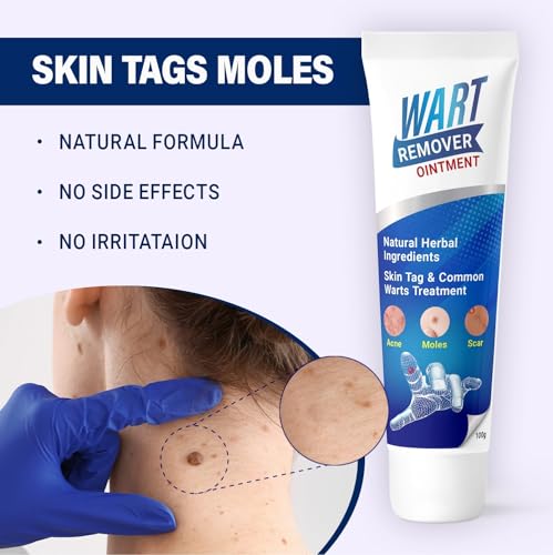 Image of Wart Remover Ointment, Wart Remover Cream For Wart Removal | Massa Remover Ointment For Skin | Skin Tag Remover Cream (wart remover cream)(100Gm)