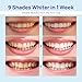 Whitebite Pro Teeth Whitening Kit for Sensitive Teeth – Dual LED Light + 35% Carbamide Peroxide Gel + Remineralizing Gel | Dental-Grade Whitening at Home