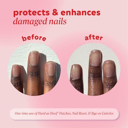 Onyx Professional Hard as Hoof Nail Repair Patches - Nail and Cuticle Strengthening Treatment, Nail Strengthener and Growth, Nail Care, 20 Count - Image 5