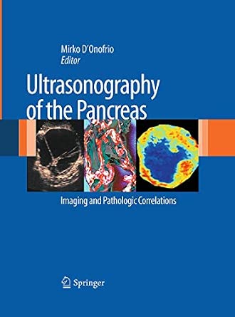 Ultrasonography of the Pancreas: Imaging and Pathologic Correlations Softcover Reprint of the Original 1st 2012 ed. Edition-Wow! eBook