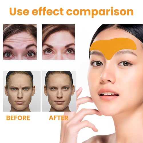 Image of Forehead Wrinkle Patch with Hydrolysed Collagen | Anti-Wrinkle Forehead Pads for Fine Lines & Aging Signs | Face Smoothing Treatment for Men & Women | Pack of 10