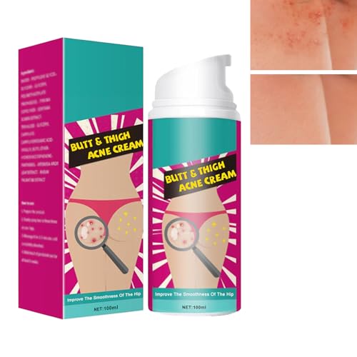 KOAHDE Crema de Acné de Cadera,Crema para Granos de Glúteos,Eliminar Granos de Gluteos,Eliminar el Acné en los Glúteos,Butt Acne,100ML,1pc