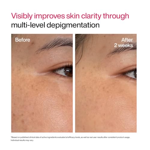 Image of WishCare Advanced Dark Spot Correcting Serum - TXA Shot | 10% Niacinamide Serum For Pigmentation and Dark Spot | With 2% Alpha Arbutin & TXA for Glowing Skin | 30ml