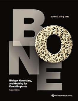 Bone: Biology, Harvesting, and Grafting for Dental Implants-Wow! eBook