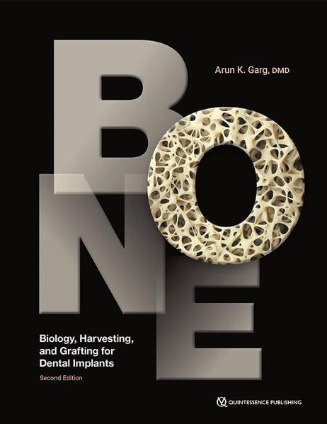 Cover for Bone: Biology, Harvesting, and Grafting for Dental Implants