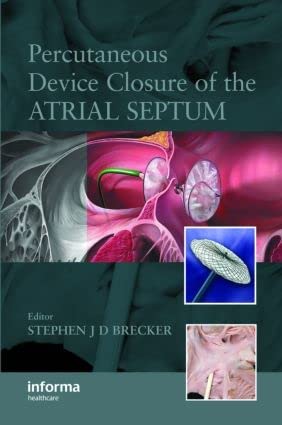 Percutaneous Device Closure of the Atrial Septum book cover