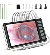 Hiacinto Digital Otoscope Camera, 7 Inch Super Large IPS Screen Ear Wax Removal Camera, 3.9mm HD ...