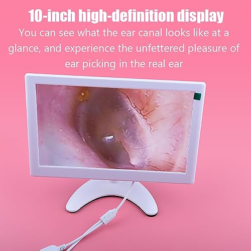 Cámara otoscopio digital para eliminar la cera del oído con pantalla 4