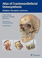 Algopix Similar Product 12 - Atlas of Craniomaxillofacial