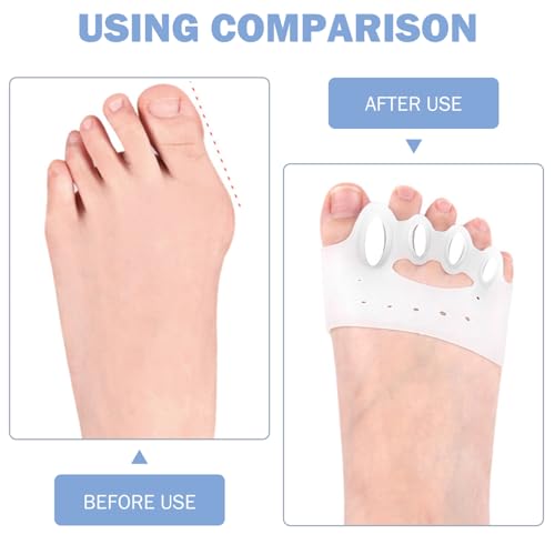 Separadores de dedos de silicona premium con corrector de juanetes reutilizable 3