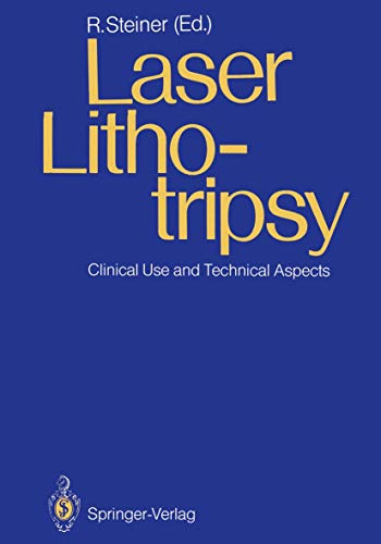 Laser Lithotripsy:...