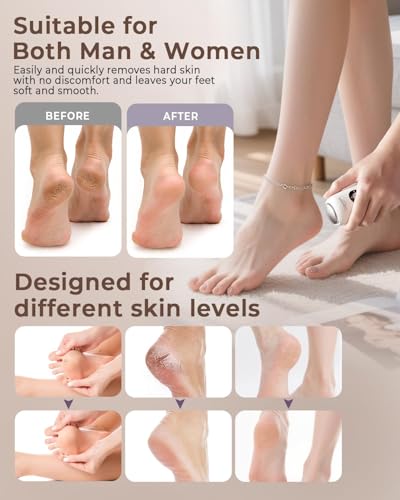 Image of Callus Remover for Feet Electronic, Rechargeable Foot Scrubber for Dead Skin Cracked Heels, 2 Stainless Steel Heads with 3 Speeds, IPX6 Waterproof Pedicure Calluses Machine