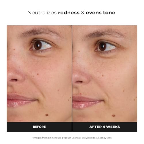 Paula's Choice SKIN BALANCING Pore-Reducing Face Toner with Niacinamide, for Oily Skin & Combination, Minimizes Large Pores, Controls Oil & Shine, Hydrates & Replenishes, Fragrance-Free - Image 4