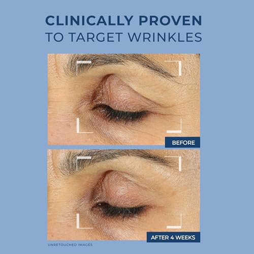 ROC Retinol Correxion Eye Cream 15ml