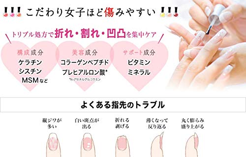 爪のでこぼこ縦線は病気 原因と自力で治し方 ネイリストが教える ニキブロ