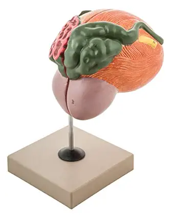 Funko Eisco Labs Human Urinary Bladder with Prostate Anatomical Model, 2 Parts, 3 Times Life Size, Approx. 8