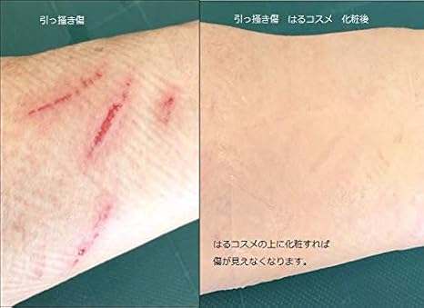 Amazon はるコスメ 傷用55 傷の保護 貼ってメイクで傷を隠す 早く綺麗に 色素沈着防止 55ｘ75 5枚 メディカルフロント はるコスメ コンシーラー 通販