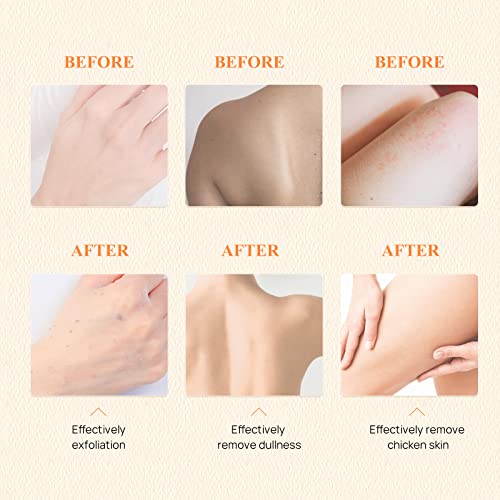 Vitamin C Scrub Cream 280G + Exfoliator Gel 100G, Lanbena Exfoliator Scrub Kit Body & Facial Scrube For Sensitive Skin Types, Blackheads Pore Dirt Clearing, Soften Cuticles #TOP3